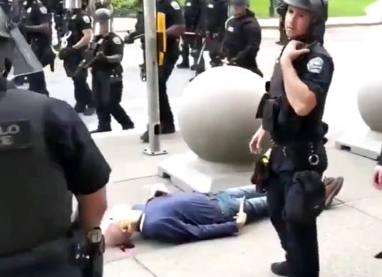 美国75岁老人被警察推倒头部流血 其律师：颅骨骨折 无法走路