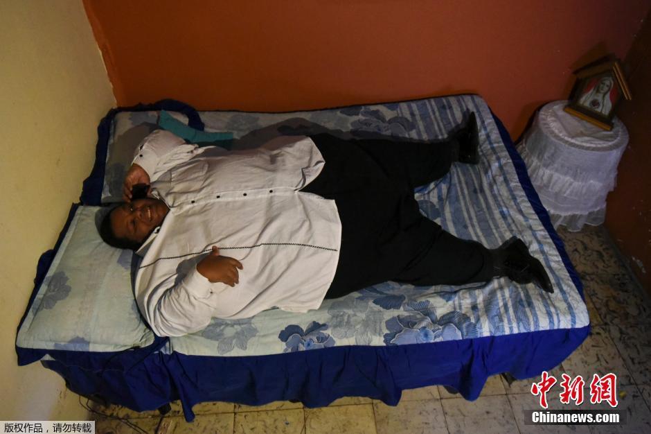 哥伦比亚800斤“第一胖”接受手术 有望减重200斤