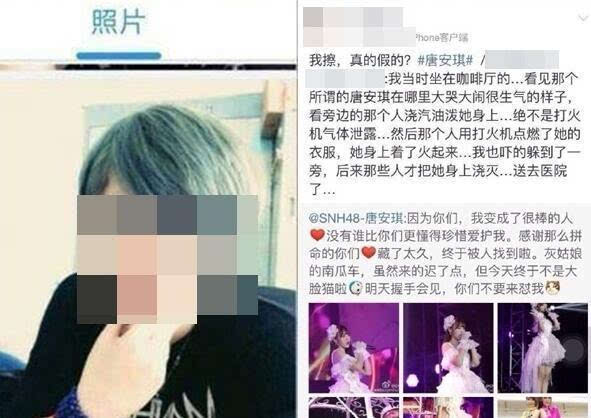 唐安琪烧伤首发声 唐安琪烧伤幕后黑手竟然是她？