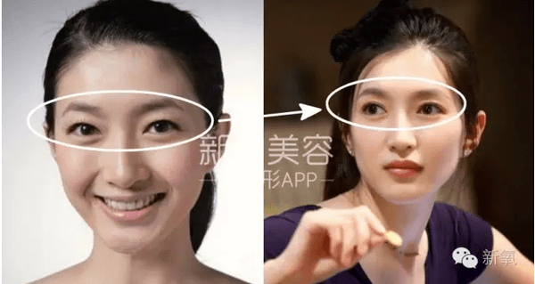 《好先生》江疏影美炸天 江疏影整容了吗?