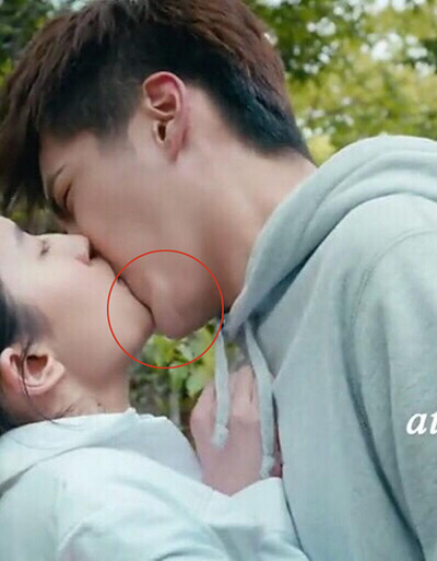 吴亦凡下巴肿么了疑似整容假体