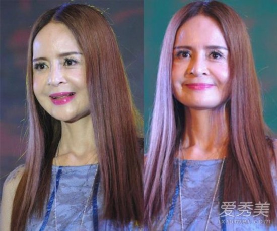 甜歌皇后高胜美近照脸僵 同龄的许晴却长这样