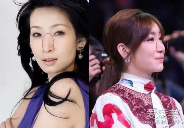 38岁秦海璐整容变网红脸 确实美了好多