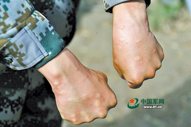 战斗在蚊虫王国的边防兵组图