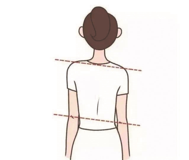 14岁女孩高低肩写作业总颈背酸痛 诊断为功能性驼背