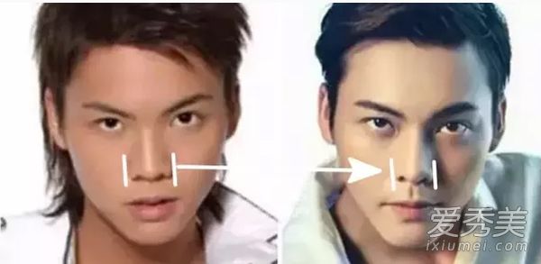 陈伟霆整容前后对比 整容前塌鼻圆脸不敢认