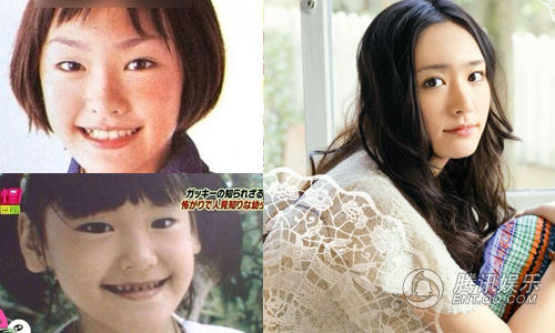 日本女星变脸后表情还能很丰富 整容术秒杀韩国_娱乐_腾讯网