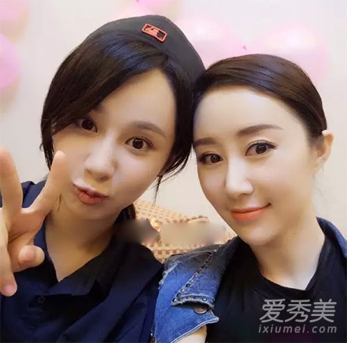 舒畅脸僵了杨紫天天变脸 明明就很美还要微调