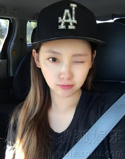 29岁张嘉倪曝近照 眼窝凹陷嘴唇红肿疑似整容