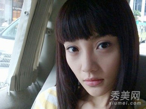 娱乐圈整容失败案例 11位女星越整越丑