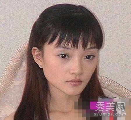 娱乐圈整容失败案例 11位女星越整越丑