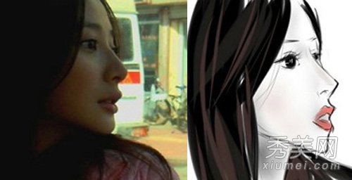 娱乐圈整容失败案例 11位女星越整越丑