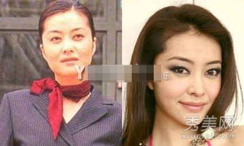 娱乐圈整容失败案例 11位女星越整越丑