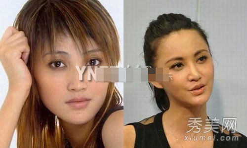 娱乐圈整容失败案例 11位女星越整越丑
