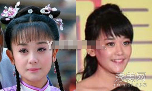 娱乐圈整容失败案例 11位女星越整越丑