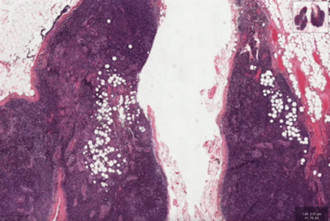 帮助医生“阅片” 腾讯将游戏AI用于疾病诊断_fororder_图片15