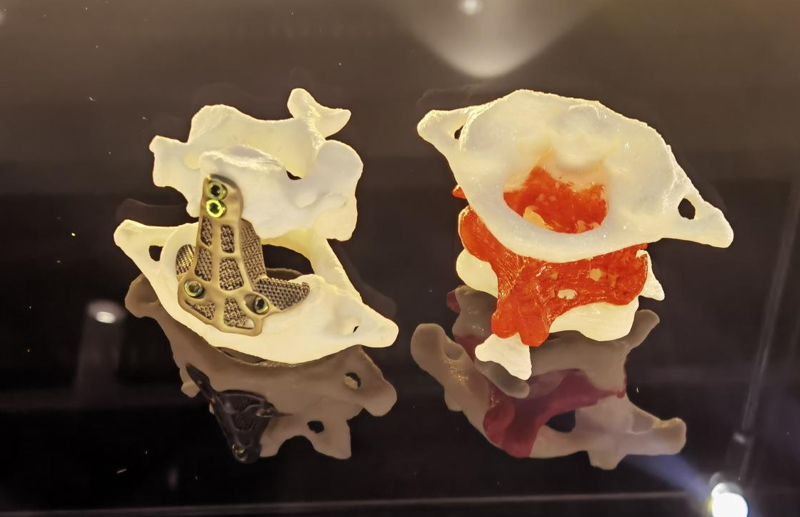 【解密四个高新】维度生物：重新定义中国骨科3D打印技术赛道_fororder_图片2