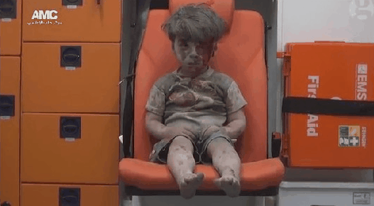 叙利亚5岁儿童空袭中死里逃生 眼神刺痛世界