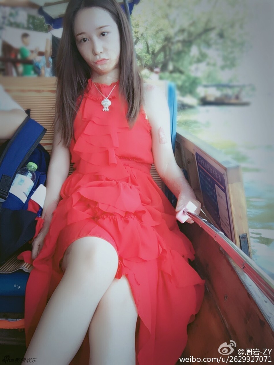 烧伤女孩周岩旧照甜美清纯 性格坚强阳光(组图)