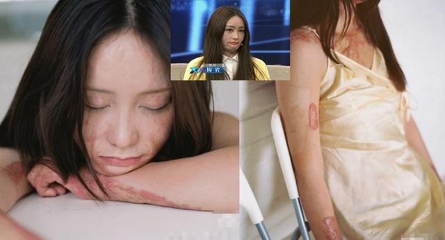 挣扎纠结过后,他们露出了自己的伤疤_娱乐_腾讯网