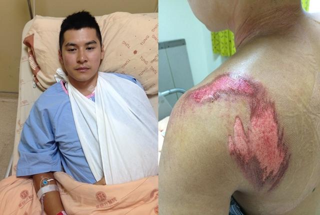 selina俞灏明胡歌挣扎纠结过后他们露出了自己的伤疤