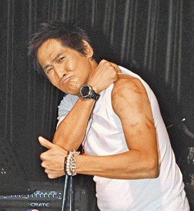 齐秦意外遭遇烧伤