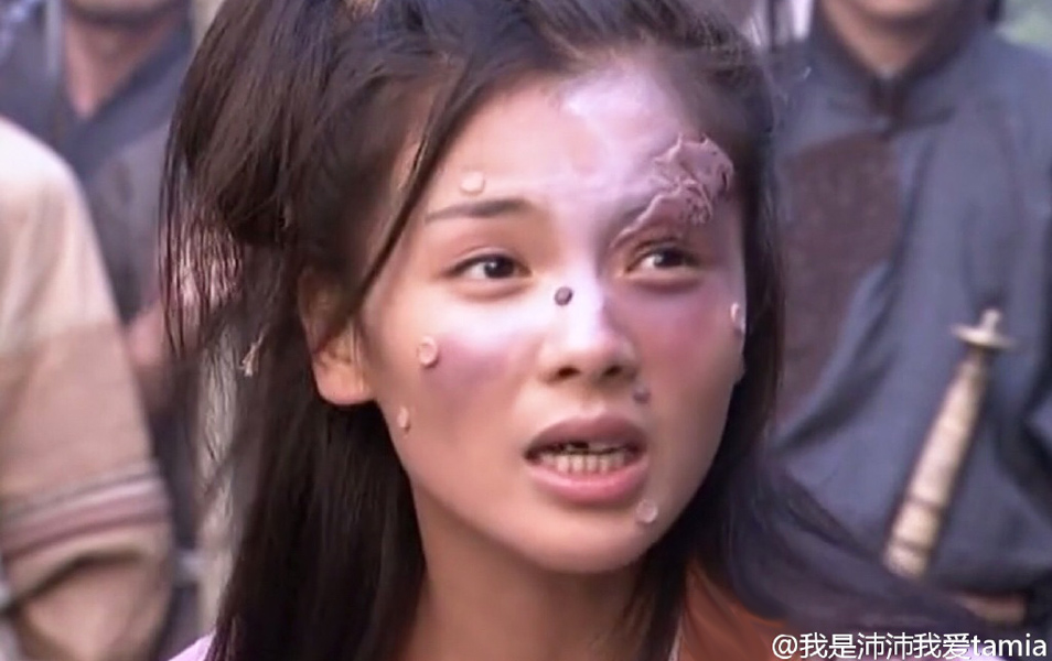 网友发刘涛昔日剧照 豁牙淤青痘痘满脸