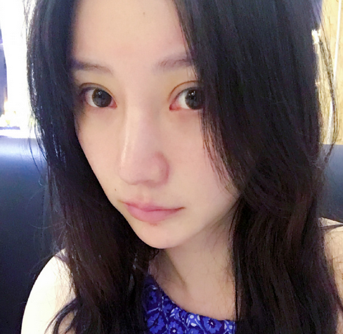 柳岩晒素颜暴露整容？眼角通红获网友“差评”