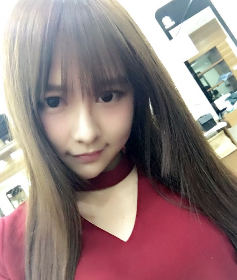 唐安琪发文首谈烧伤:自己不小心造成的意外