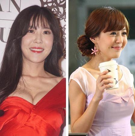 她们是娱乐圈最不该整容的五大女星 美嘉你是肿么了