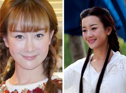 她们是娱乐圈最不该整容的五大女星 美嘉你是肿么了