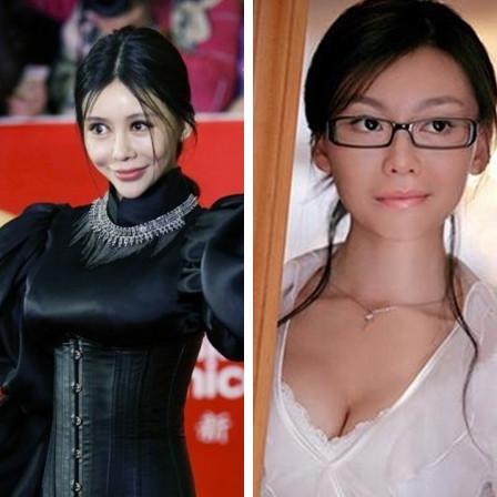 她们是娱乐圈最不该整容的五大女星 美嘉你是肿么了