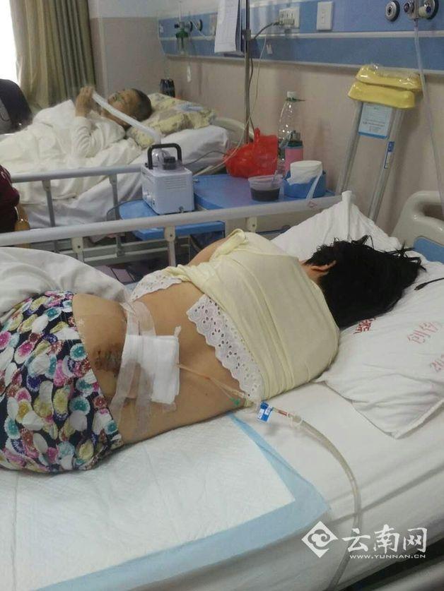 女孩患腿疾13年 姐姐干苦力背香蕉攒手术钱(图)