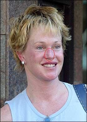 史上整容最失败的外国女明星 惨不忍睹 慎入!