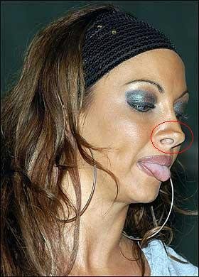 史上整容最失败的外国女明星 惨不忍睹 慎入!