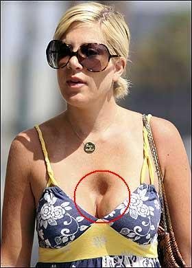 史上整容最失败的外国女明星 惨不忍睹 慎入!