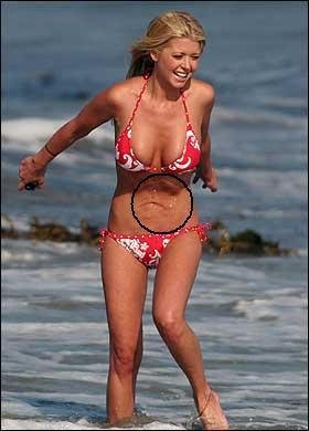 史上整容最失败的外国女明星 惨不忍睹 慎入!