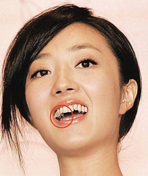 牙齿往里扣的女人面相图片