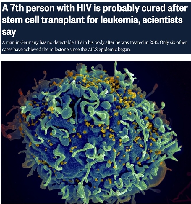 全球第七名艾滋病治愈患者被确认