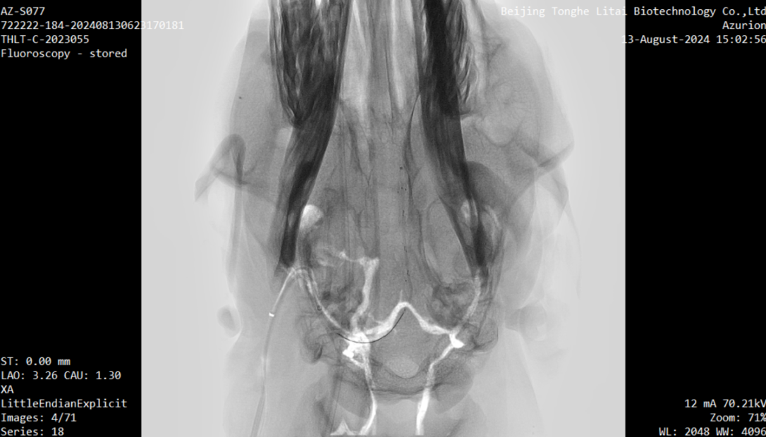 南开介入式脑机接口再突破 成功完成介入式脑机接口传感器血管内取出试验_fororder_3