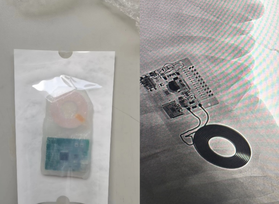 南开介入式脑机接口再突破 成功完成介入式脑机接口传感器血管内取出试验_fororder_2