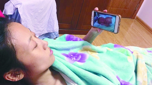 懷孕29周查出肝癌 女孩堅持生下寶寶