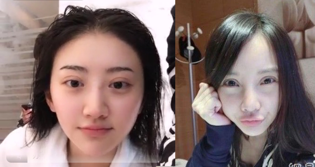 景甜素顏直播 雙眼皮比李小璐都寬