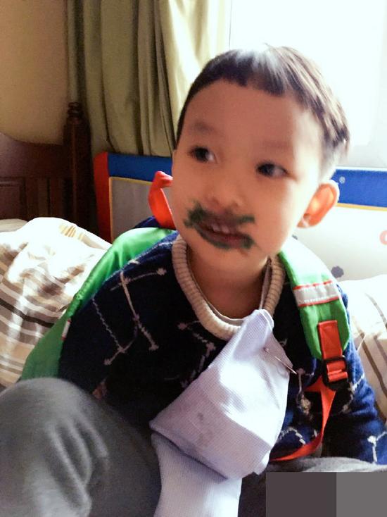 实力坑妈！姚晨儿子土豆脸部成彩盘