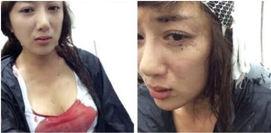 叶璇“狗官司”逆袭李依晓 撰长文详述伤人始末