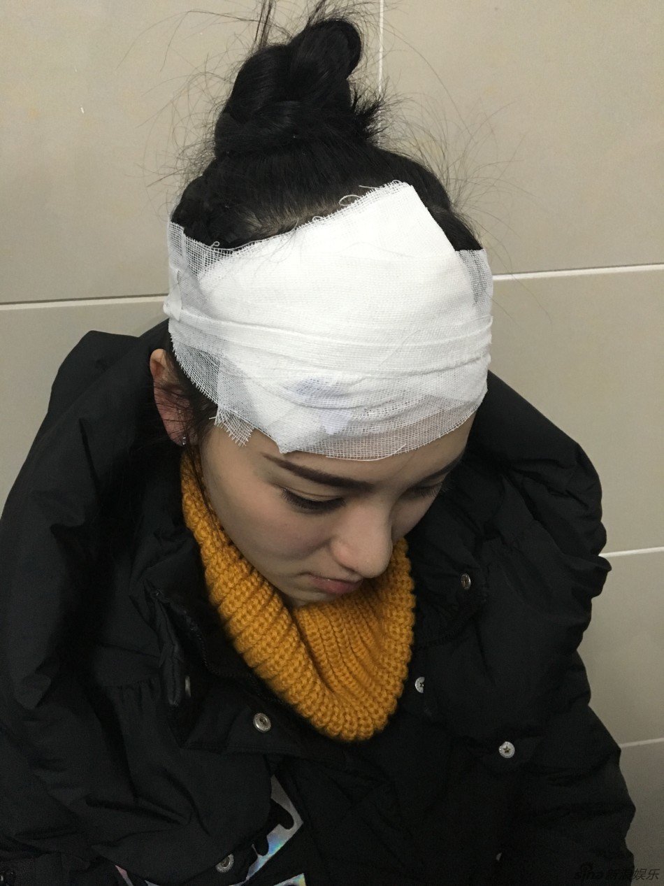 武大校花拍戏被砸黄灿灿头部伤口清晰可见组图