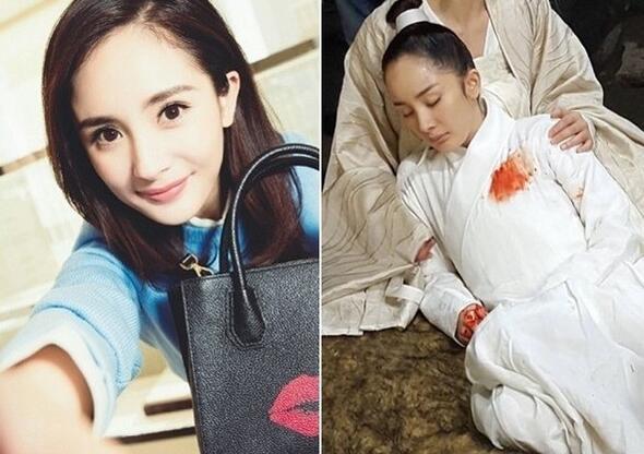 杨幂的发际线再也回不去了么?网友吐槽像半秃