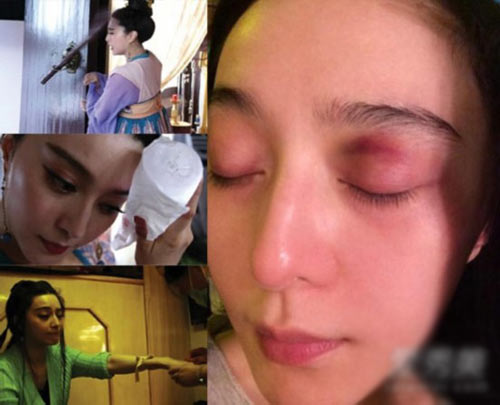 薛之谦晕倒杨幂吃土明星比拼谁更胜一筹