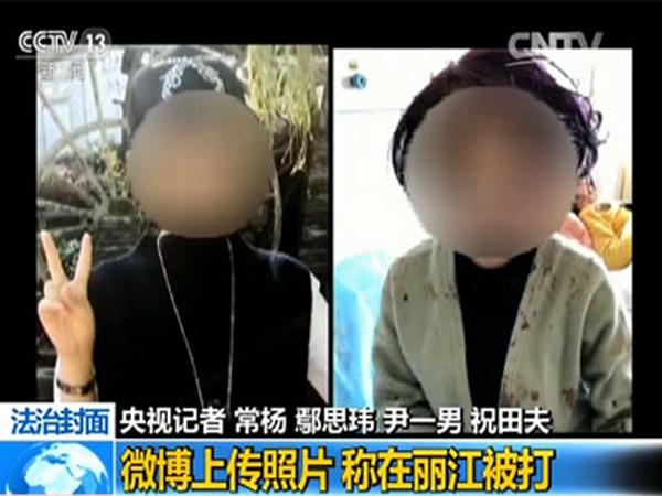 丽江女游客被打细节:打人者曾学东北话说"咋的啦"