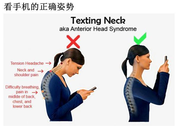 【焦點圖】【即時快訊】警惕“手機脖”！長時間玩手機的正確姿勢，你get到了嗎？